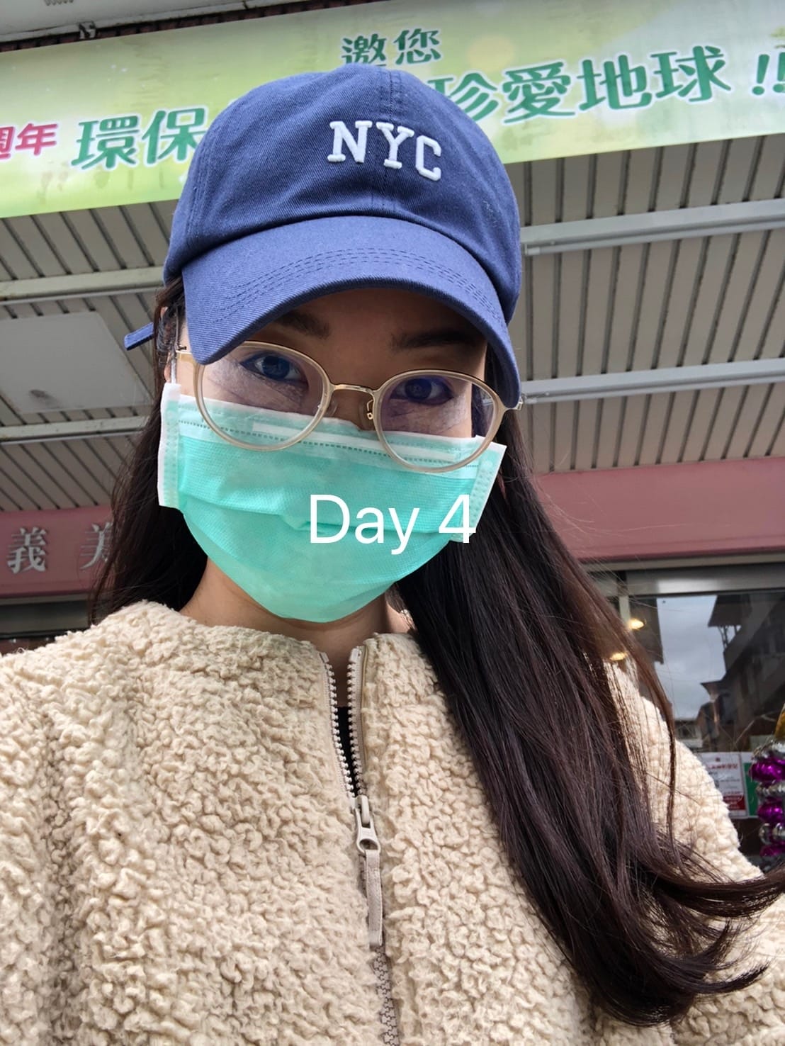 眼袋手術(內開) saybyebye復原紀錄 | 佳思優整形