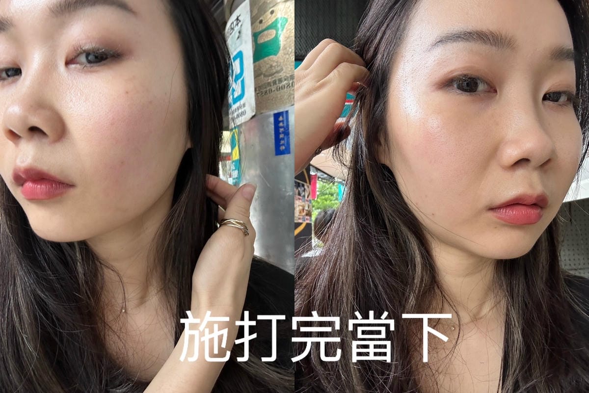 海芙音波會痛嗎？到底該打多少條? 重現完美下顎線，瞬間提升蘋