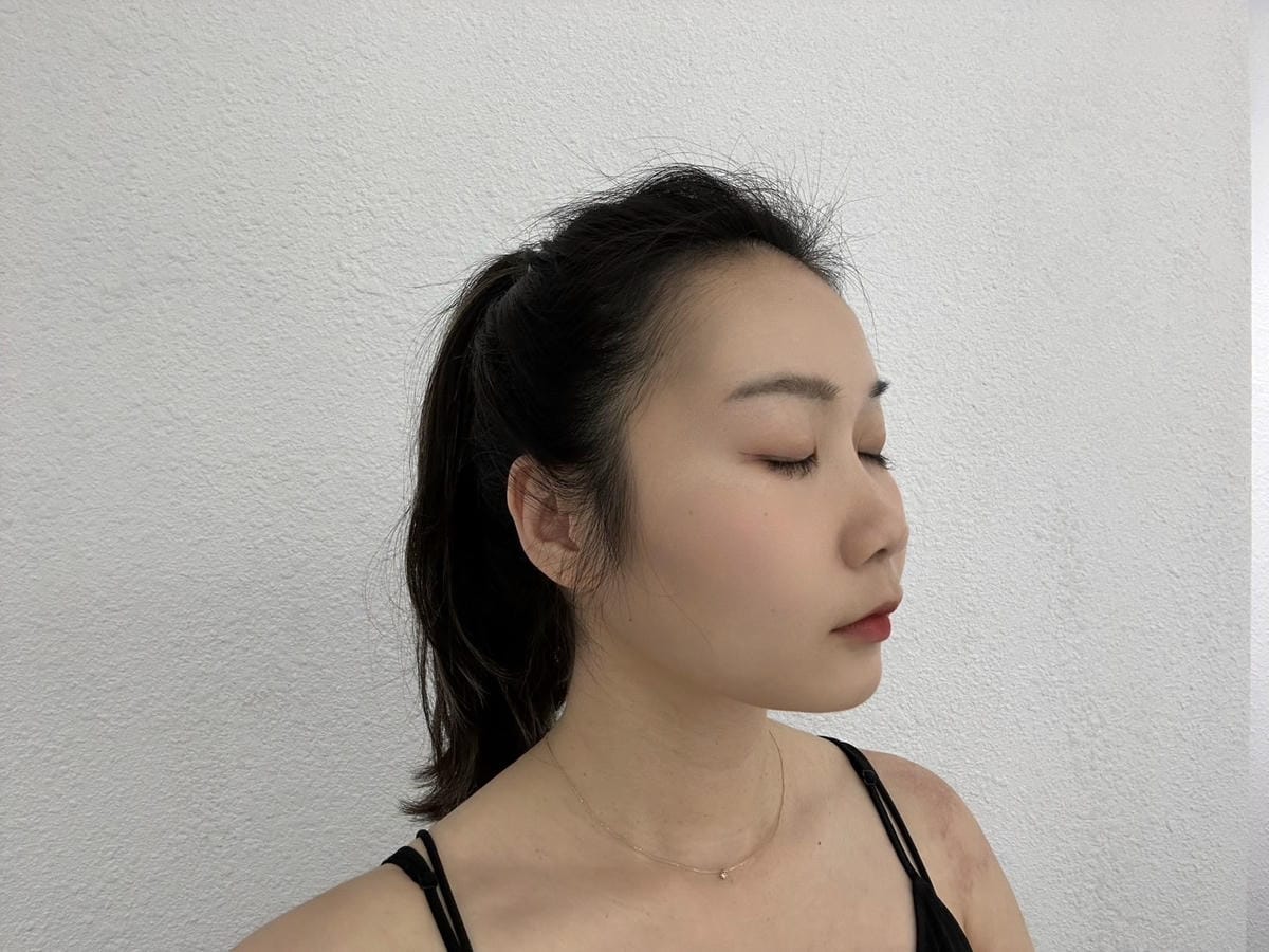 海芙音波會痛嗎？到底該打多少條? 重現完美下顎線，瞬間提升蘋
