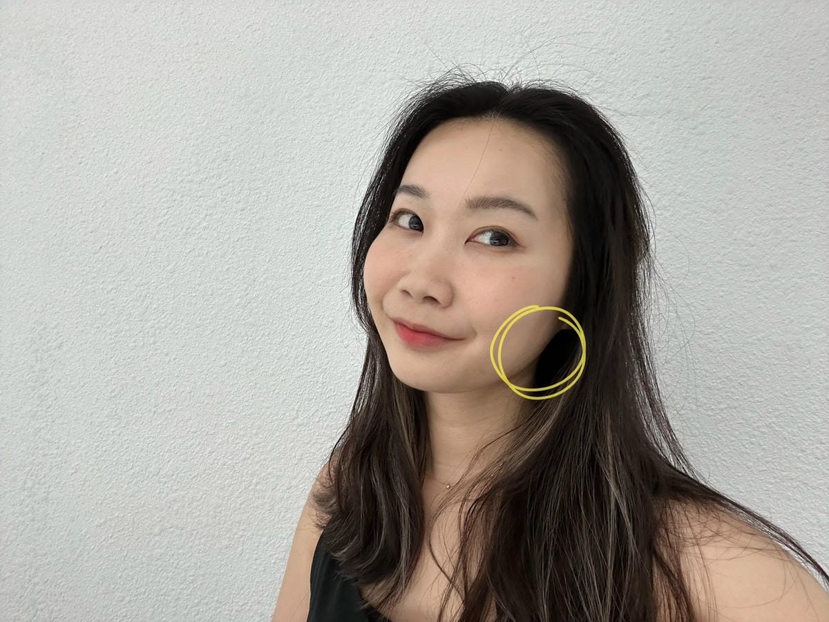 改善咀嚼肌肉毒瘦小臉有感│GM冠美國際時尚診所 改善咀嚼肌肉毒瘦小臉有感│GM冠美國際時尚診所