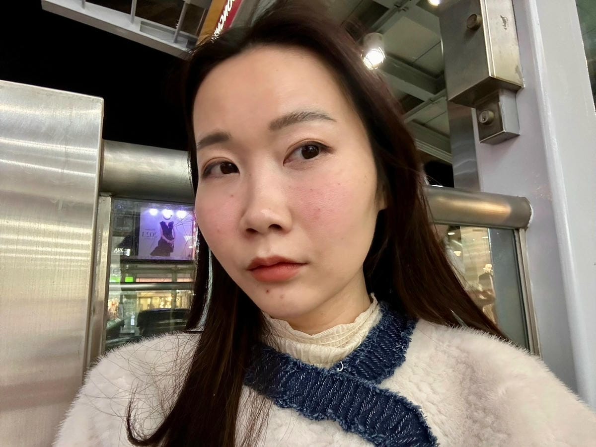 關於微整形功課，喬雅登VOLBELLA玻尿酸淚溝施打推薦！不
