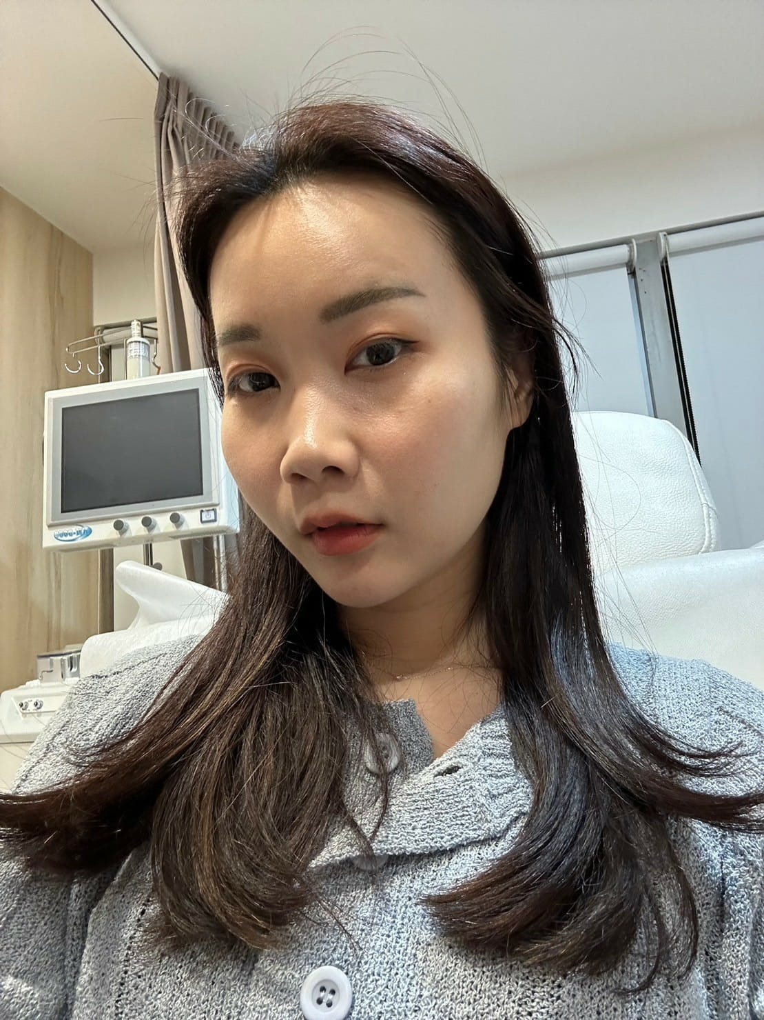 關於微整形功課，喬雅登VOLBELLA玻尿酸淚溝施打推薦！不