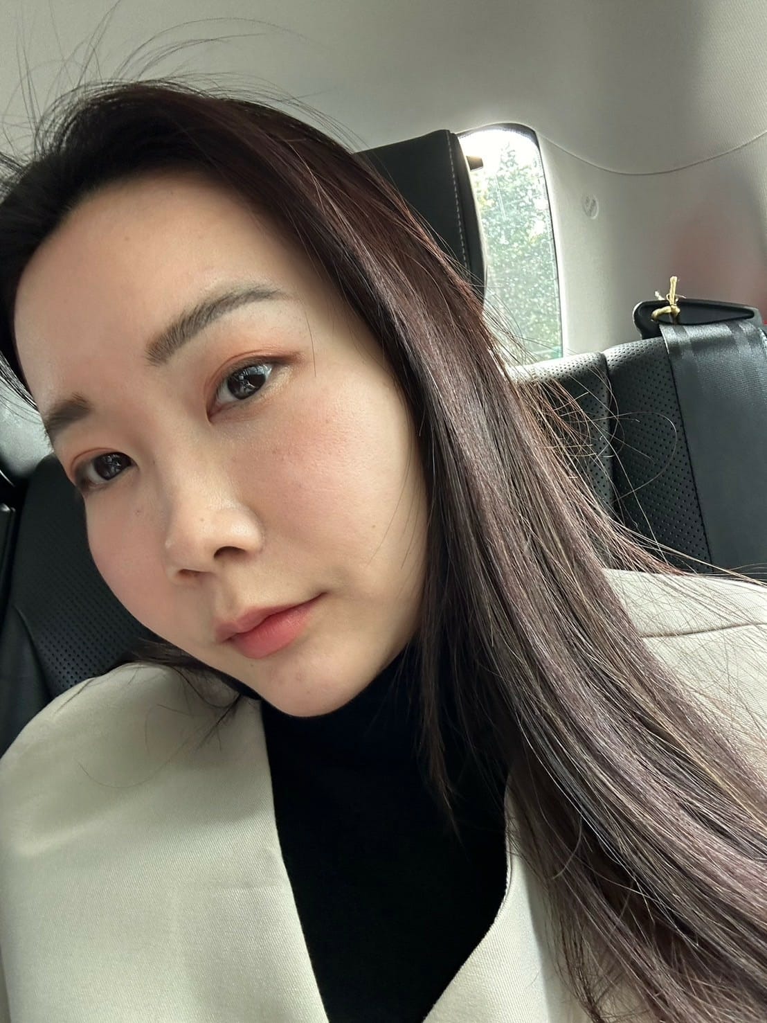 關於微整形功課，喬雅登VOLBELLA玻尿酸淚溝施打推薦！不