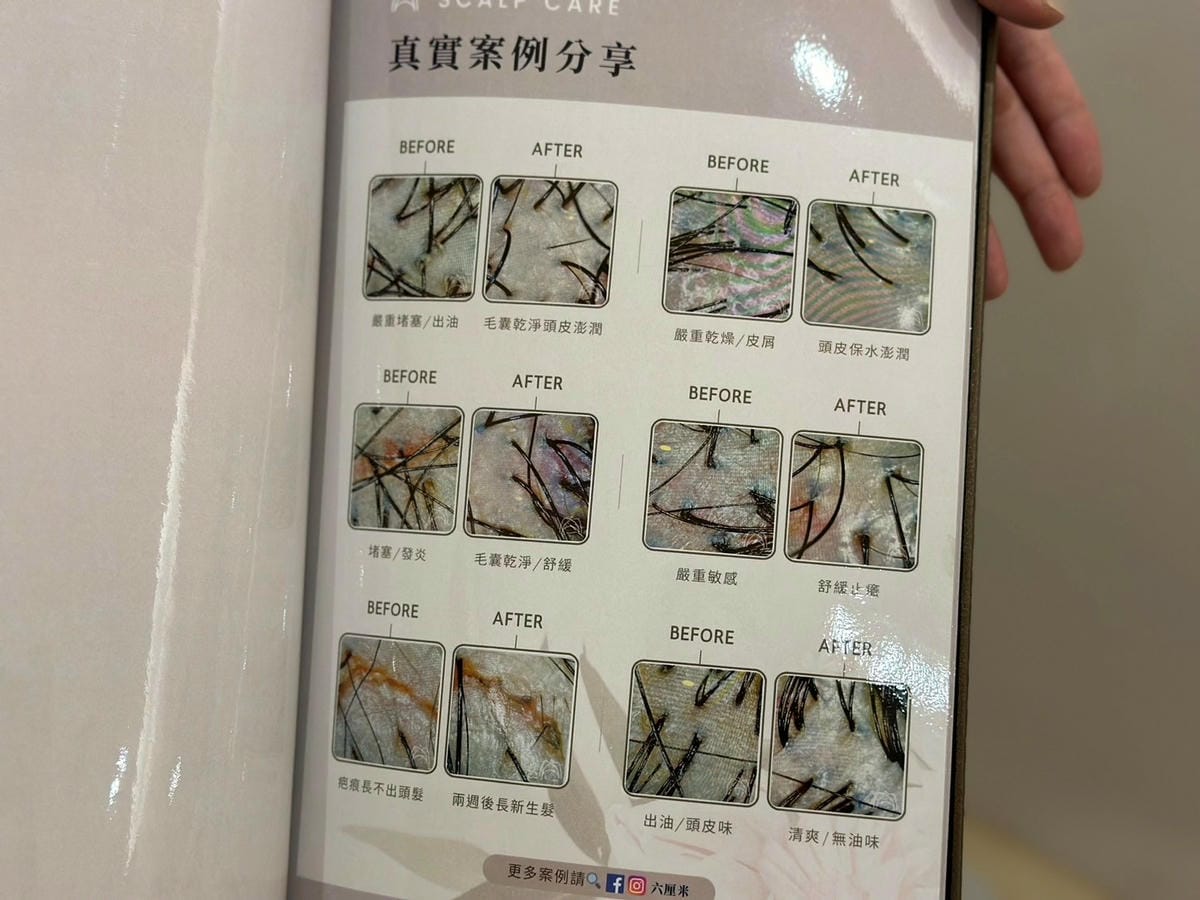 沉浸式頂級育髮松山區頭皮養護推薦：如何擁有健康頭皮｜六厘米 