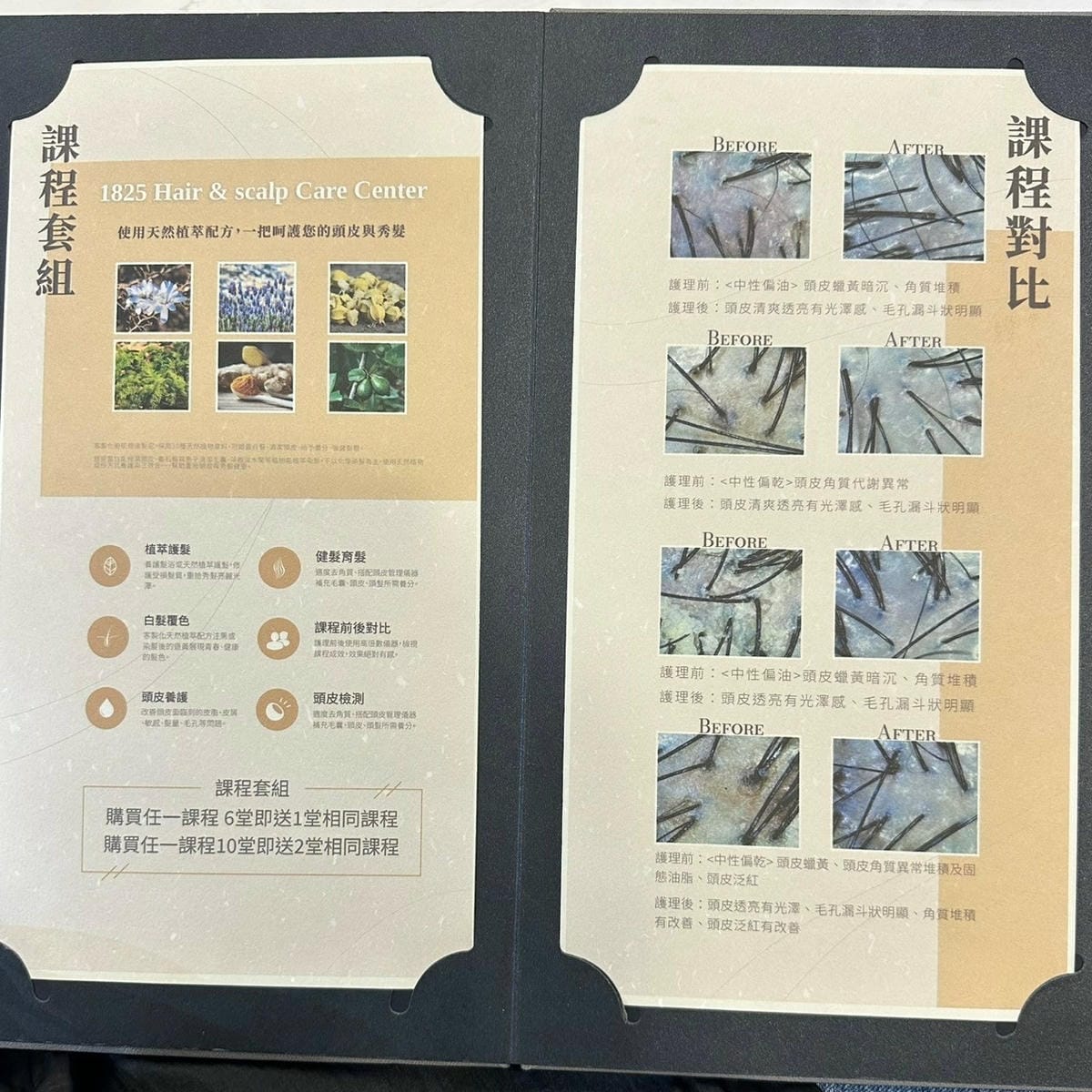 LINE_ALBUM_頭皮_241231_22.jpg