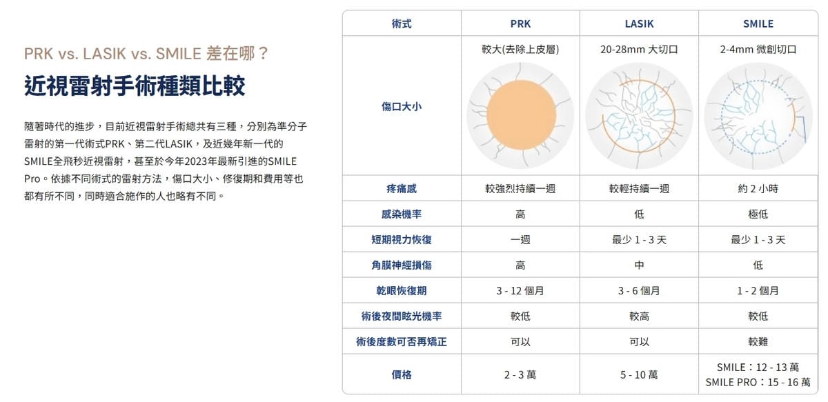 台北近視雷射推薦｜SMILE Pro 2.0微創全飛秒近視雷