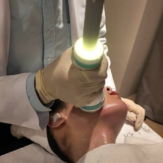 肉肉臉、雙下巴有救了！ONDA超微波讓我臉小一號 │ 悅緹妍