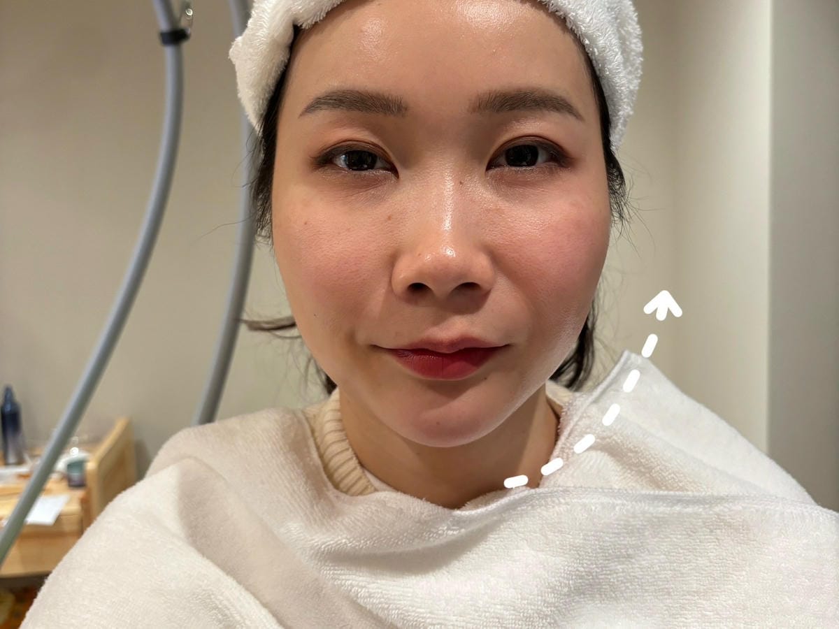 肉肉臉、雙下巴有救了！ONDA超微波讓我臉小一號 │ 悅緹妍