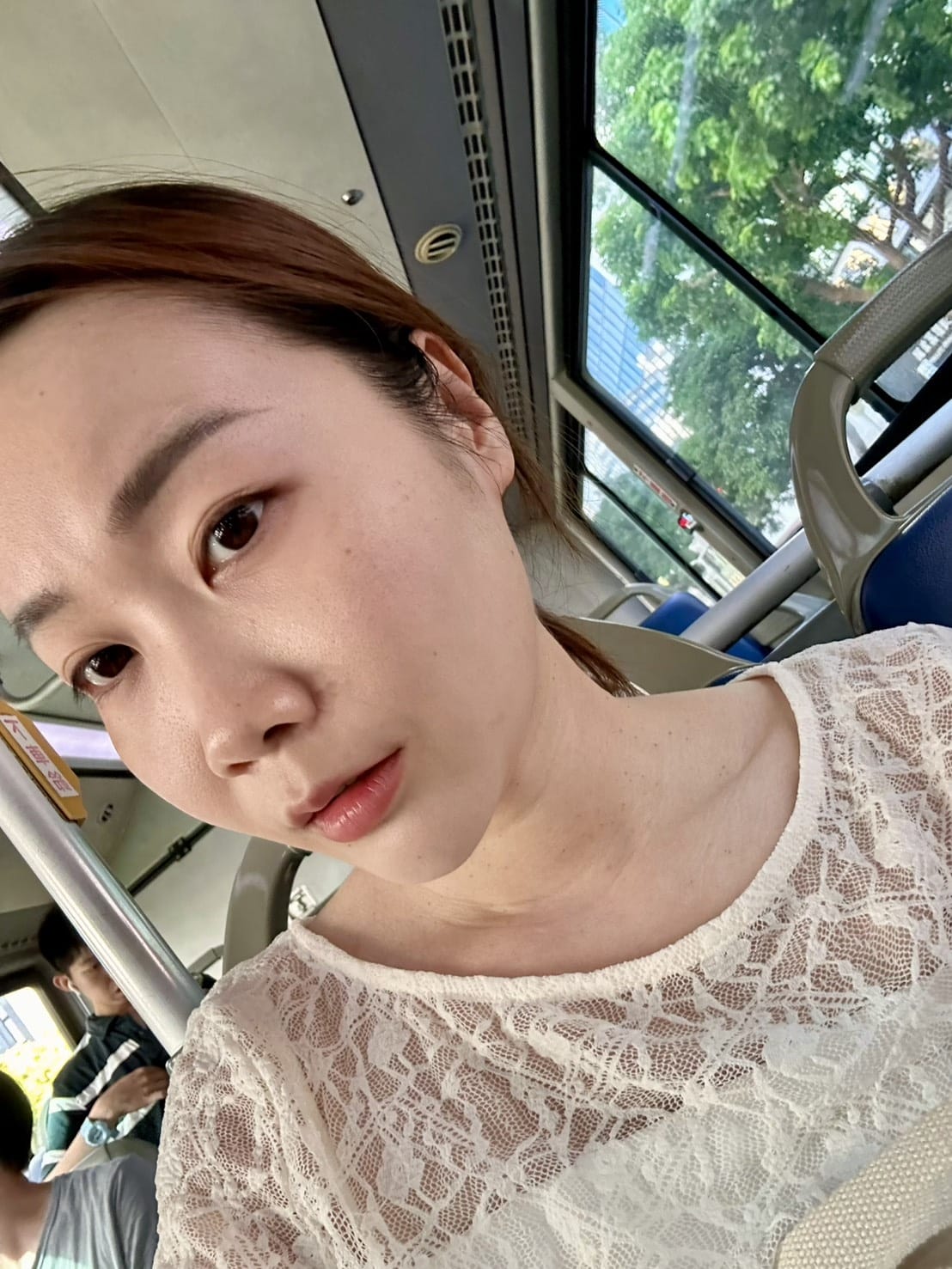 偷偷變美日記｜松江南京 九五太承醫美診所Z音波+雙線音波體驗
