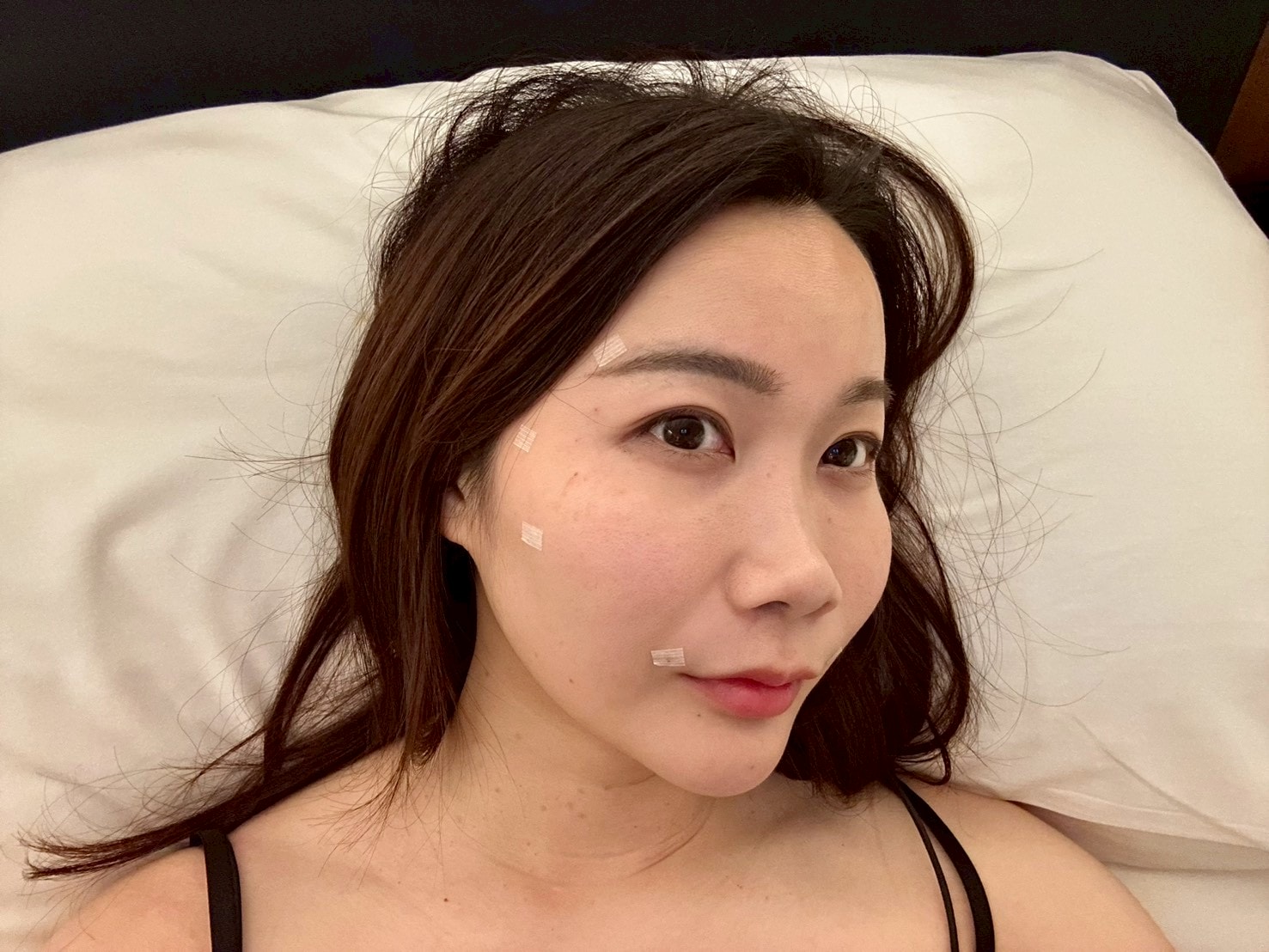 泰國曼谷醫美體驗｜曼谷音波拉提推薦？泰國醫美諮詢流程與中文服務心得Best Friend Clinic