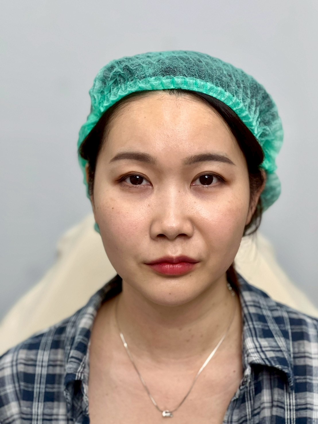 泰國曼谷醫美體驗｜曼谷音波拉提推薦？泰國醫美諮詢流程與中文服務心得Best Friend Clinic