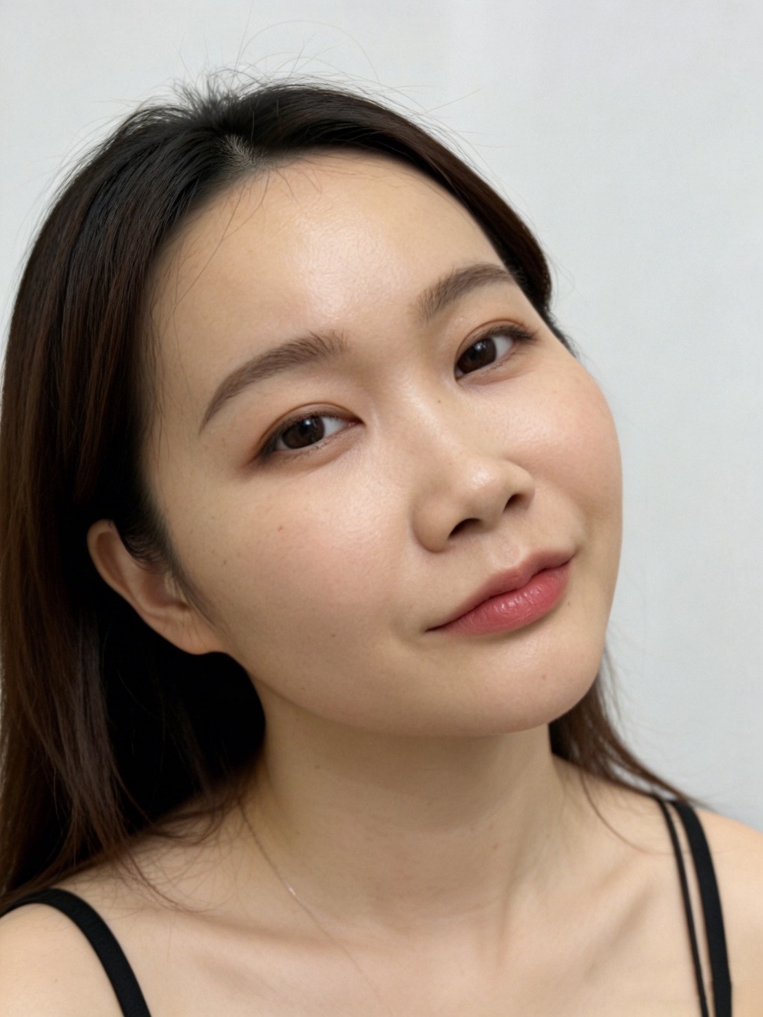 泰國曼谷醫美體驗｜曼谷音波拉提推薦？泰國醫美諮詢流程與中文服務心得Best Friend Clinic
