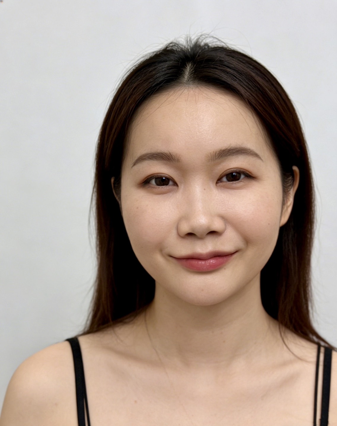 泰國曼谷醫美體驗｜曼谷音波拉提推薦？泰國醫美諮詢流程與中文服務心得Best Friend Clinic